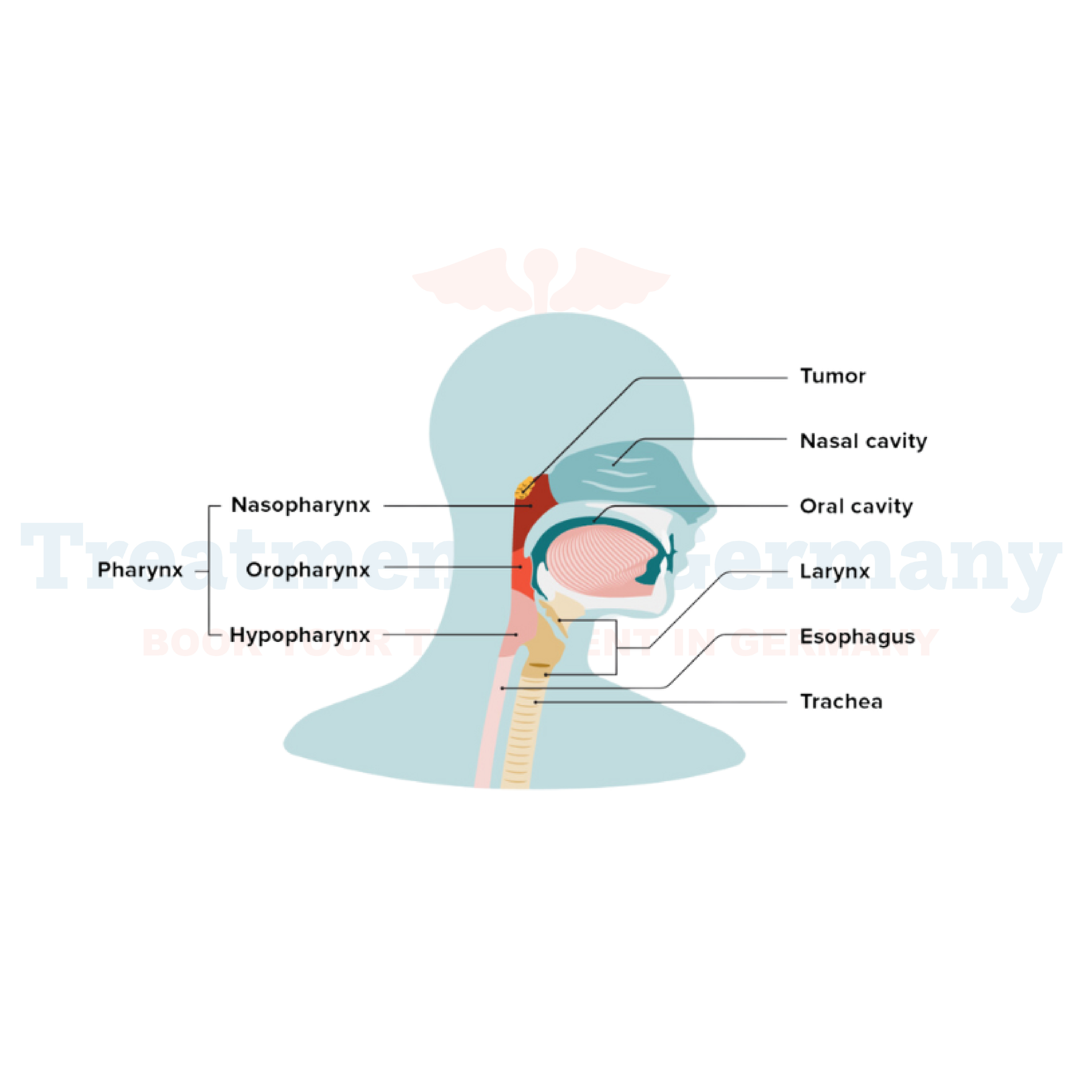 Nasopharyngeal Cancer